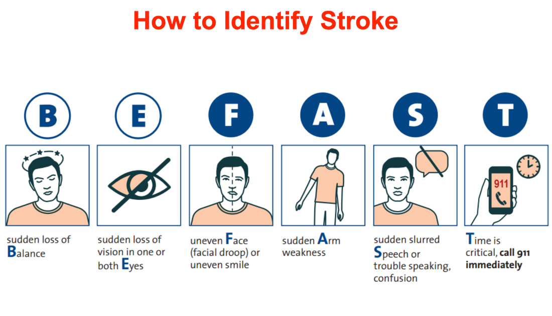 Know the Signs: How to Spot a Stroke F.A.S.T. - Bloomingdale Aging in Place